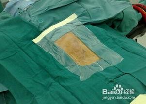 外科消毒铺巾视频,外科消毒铺巾操作步骤详解